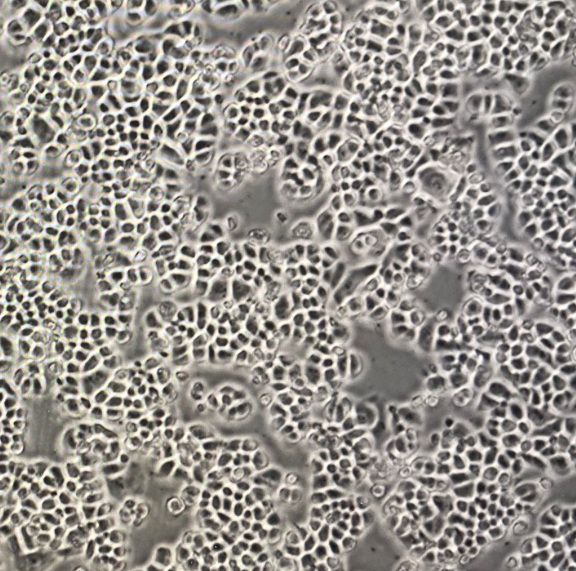 OVSAHO���ѳ����������īI���îaƷ��